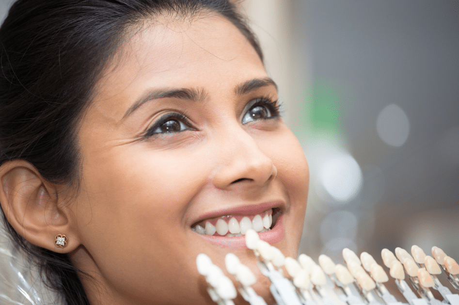 different colors matches for veneers